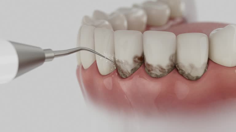 Reliable Dental contractor in Talbot County County, GA by Dentist Open Now